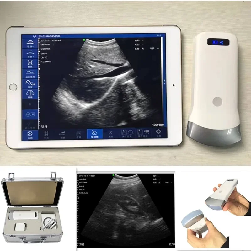 

Беспроводной ультразвуковой сканер 80E, выпуклый зонд 3,2 МГц с поддержкой IOS, Android, Windows