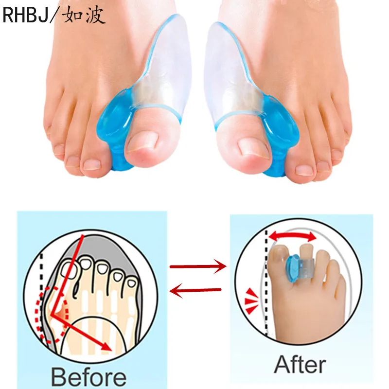 2 pçs = 1 par de silicone dedos do pé separador osso de união ectropion ajustador toes aparelho exterior ferramentas de cuidados com os pés hallux