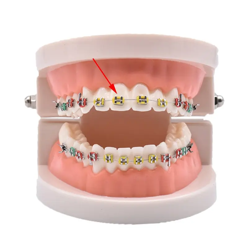 10sticks Dental Orthodontic Ligature Ties Elastic Rubber Bands Dentist Tools Braces Elasticity for Teeth Multi Color