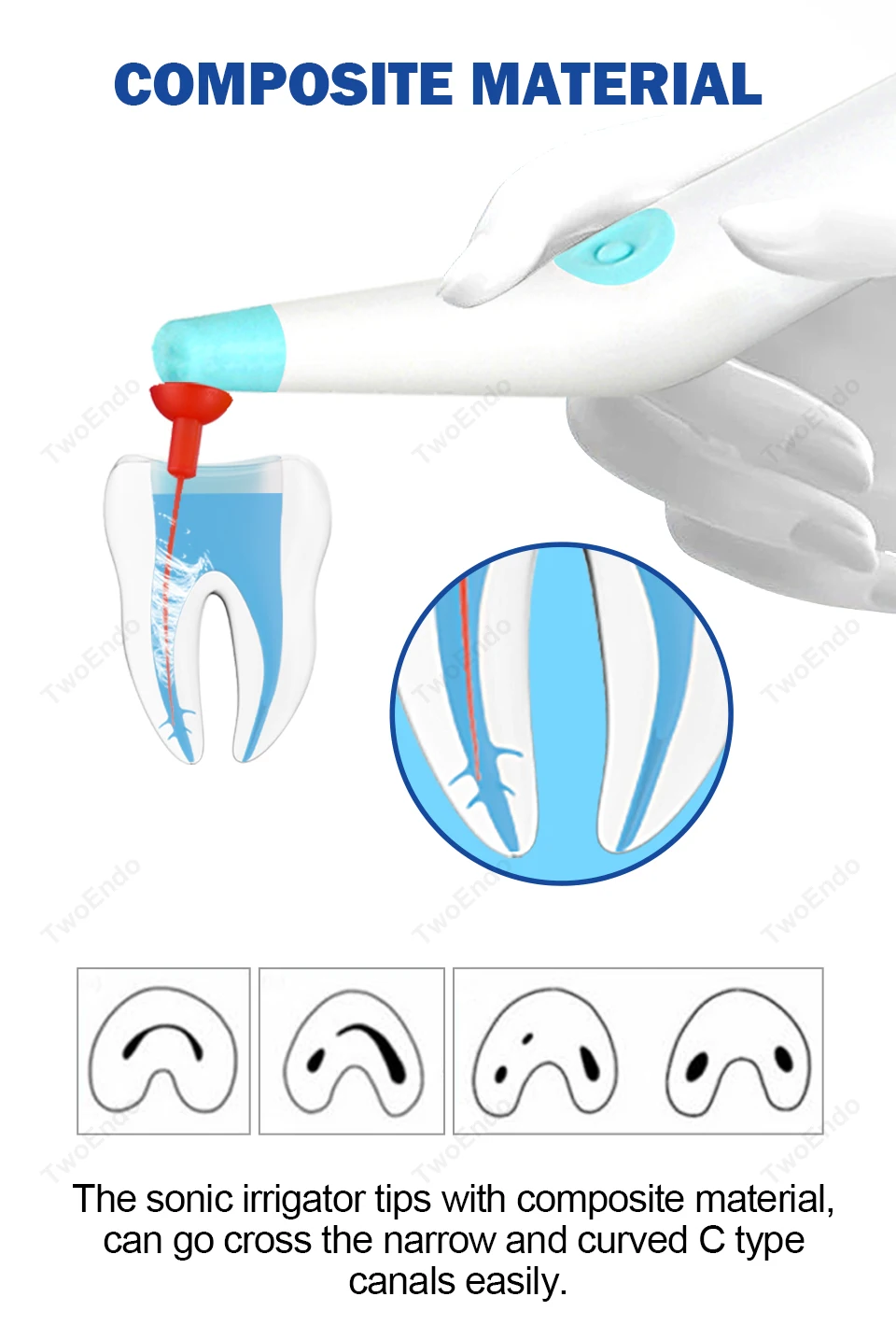 20 Stück Dental Endo Sonic Irrigator Tipps für Wurzelkanalbehandlung Zahnarztmaterialien – Detail 3