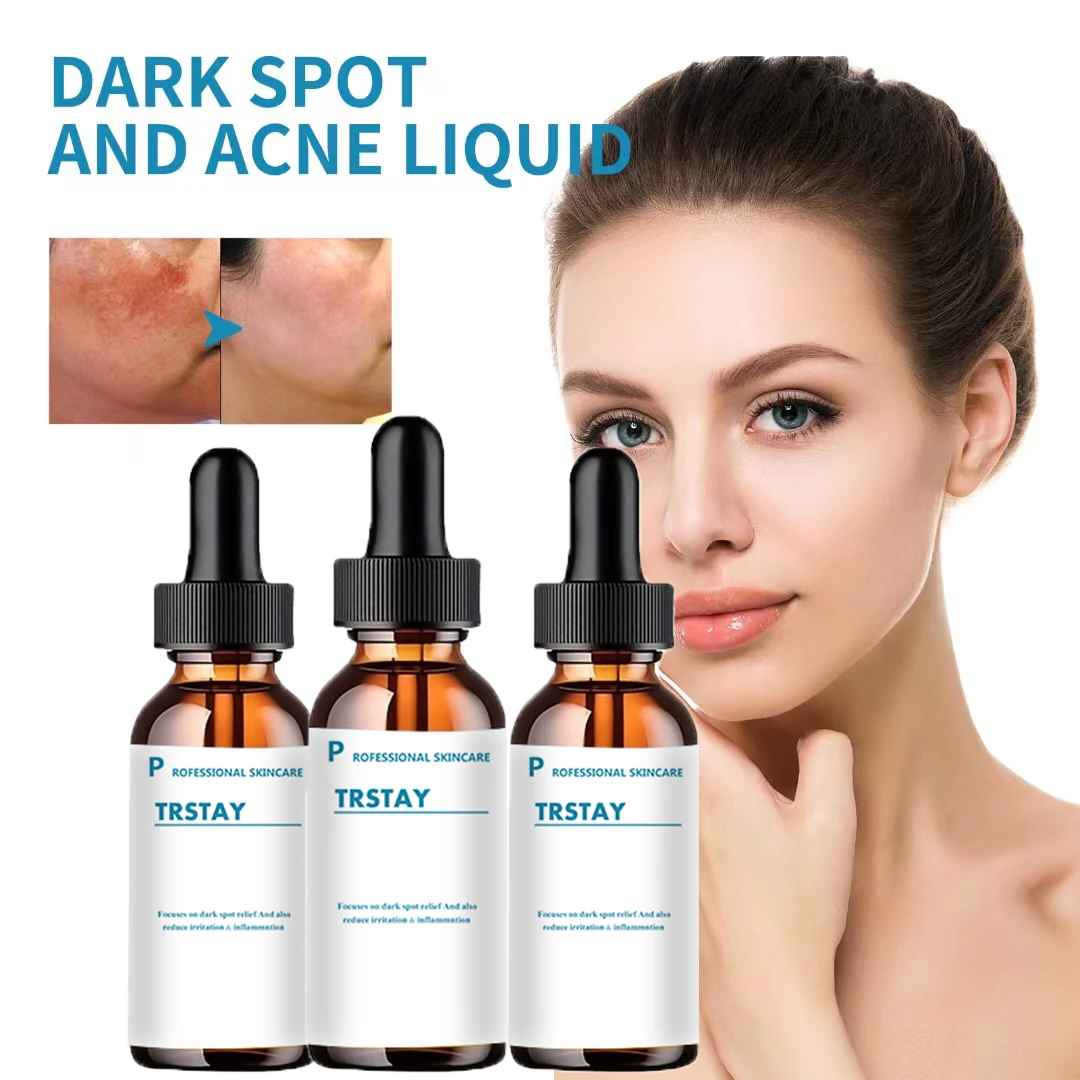 

Retinol Serum Anti Wrinkle Fade Dark Spots Vitamin C Facial Serum Whiten Face Skincare Essence Skin Care Products