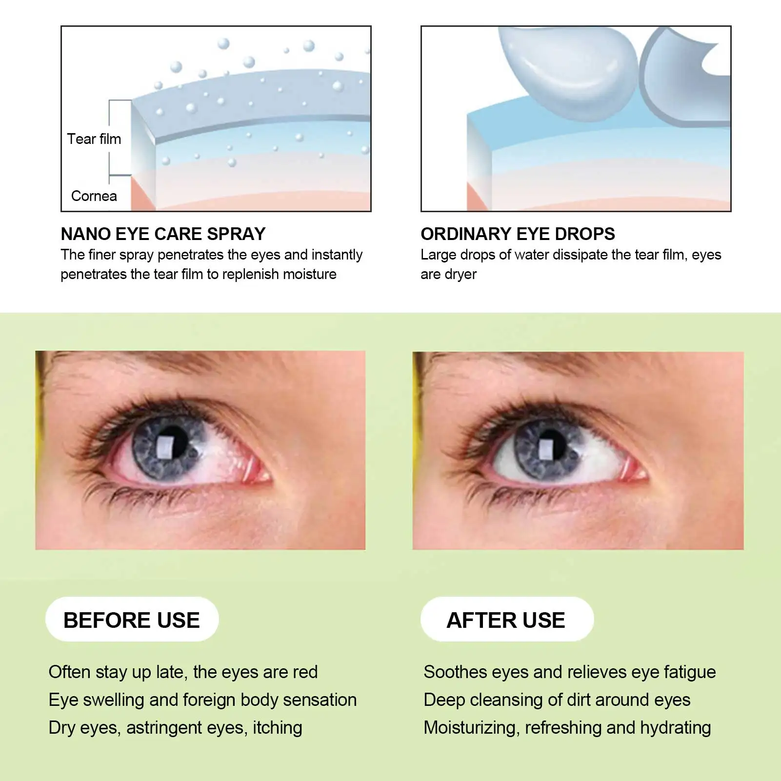 Eye Moisturizing Spray USB Charging 5V 15ml Handheld Eye Care Spray Portable Eye Moisturizing Cleaning Soothing Machine - Detail 1
