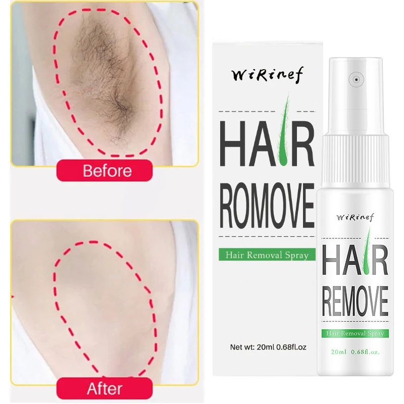 

Новый депиляционный спрей для долговременного ингибирования волос