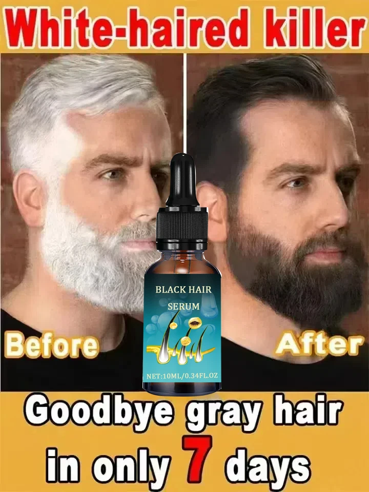 

Assassino de cabelos brancos, restaurar a cor natural do cabelo