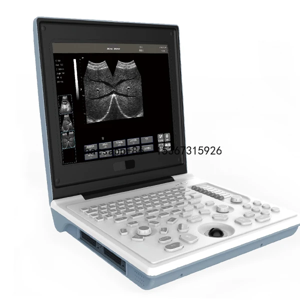 Laptop All-Digital Ultrasound Diagnostic SS-6B