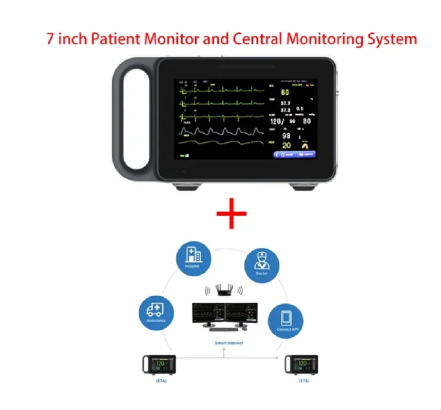 شاشة محمولة تعمل باللمس جهاز مراقبة المريض ، 6 معلمات ، ECG ، NIBP ، RESP ، SPO2 ، PR ، TEMP ، 7 بوصة ، بشري وطبيب بيطري