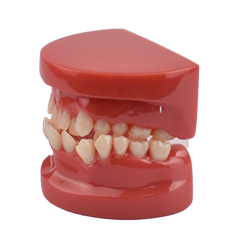 Dental Lab Teeth Malocclusion Model Demonstration Model for Training Studying Teaching Oral Model Dentistry Tools