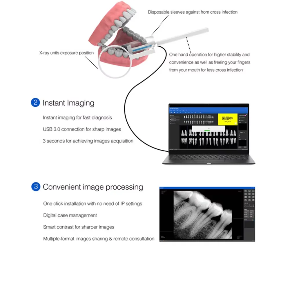 

JUMTOP Professional Dental Digital RVG Intraoral X-ray Sensor - HD Waterproof Imaging System for Accurate Diagnostic Use