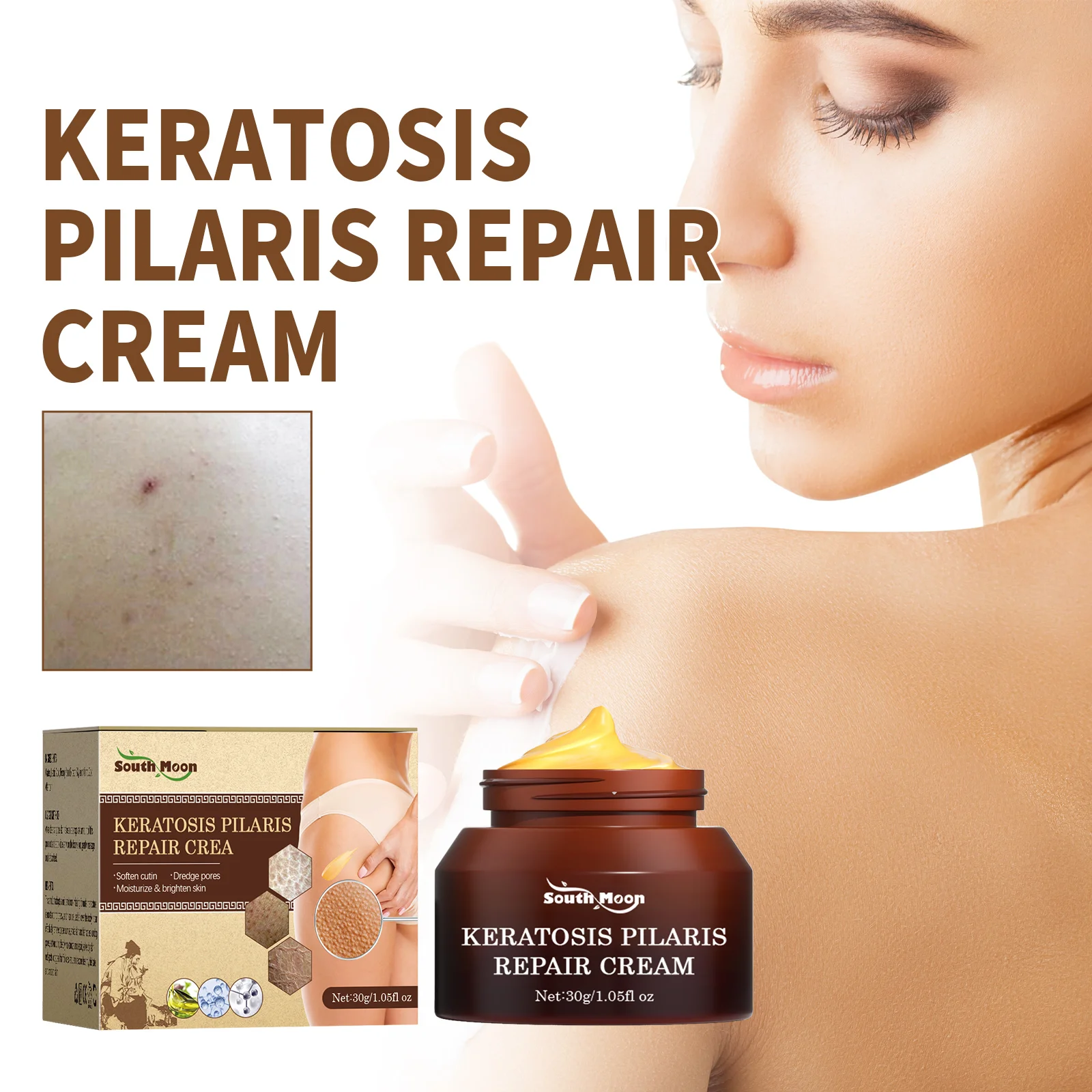 Keratosis Pilaris Removal Cream Chicken Skin Folliculities Treatment Repair Whitening Moisturizing Smooth Mild Body Lotion 30G