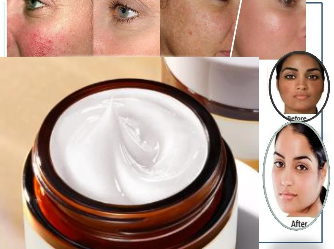 

Remove freckle speckle peels dark spot face facial skin whitening cream