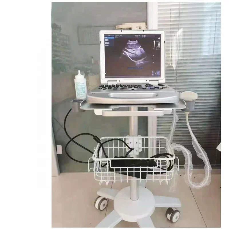 Aircraft-grade Aluminum Medical Mobile Trolley Cart Trolley for Ultrasound portable