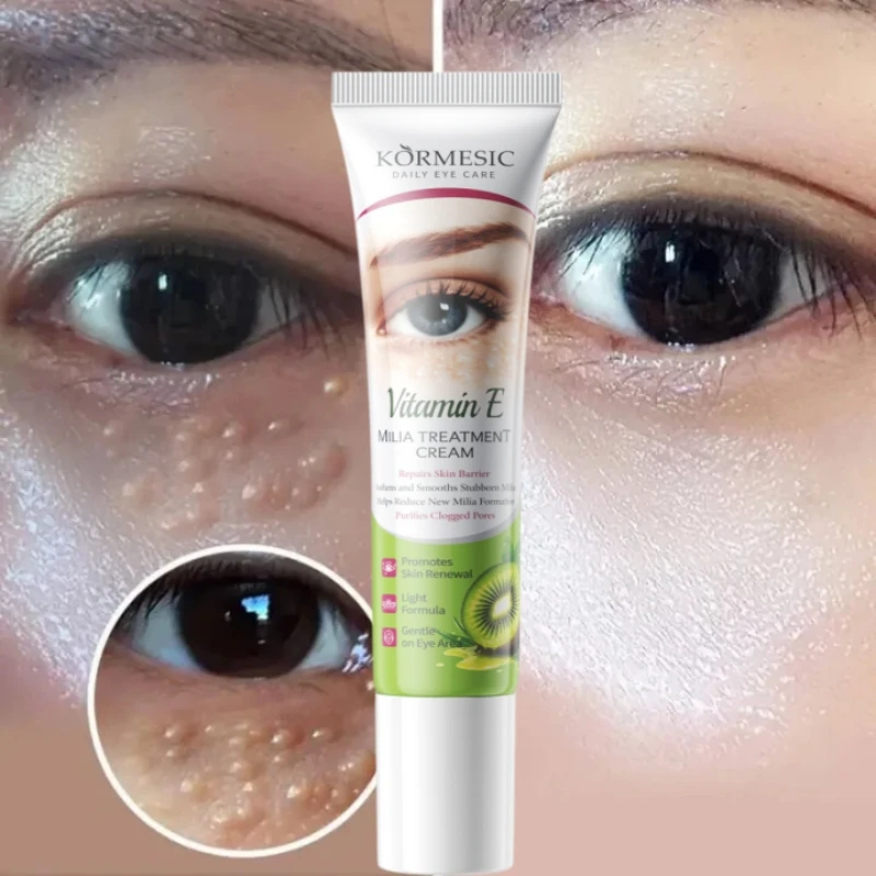Anti Fat Granules Eye Cream  Eye Milia Repair Treatment Products Improve Eye Bag Anti-Puffiness Moisturizing Lift Firm Skin Care