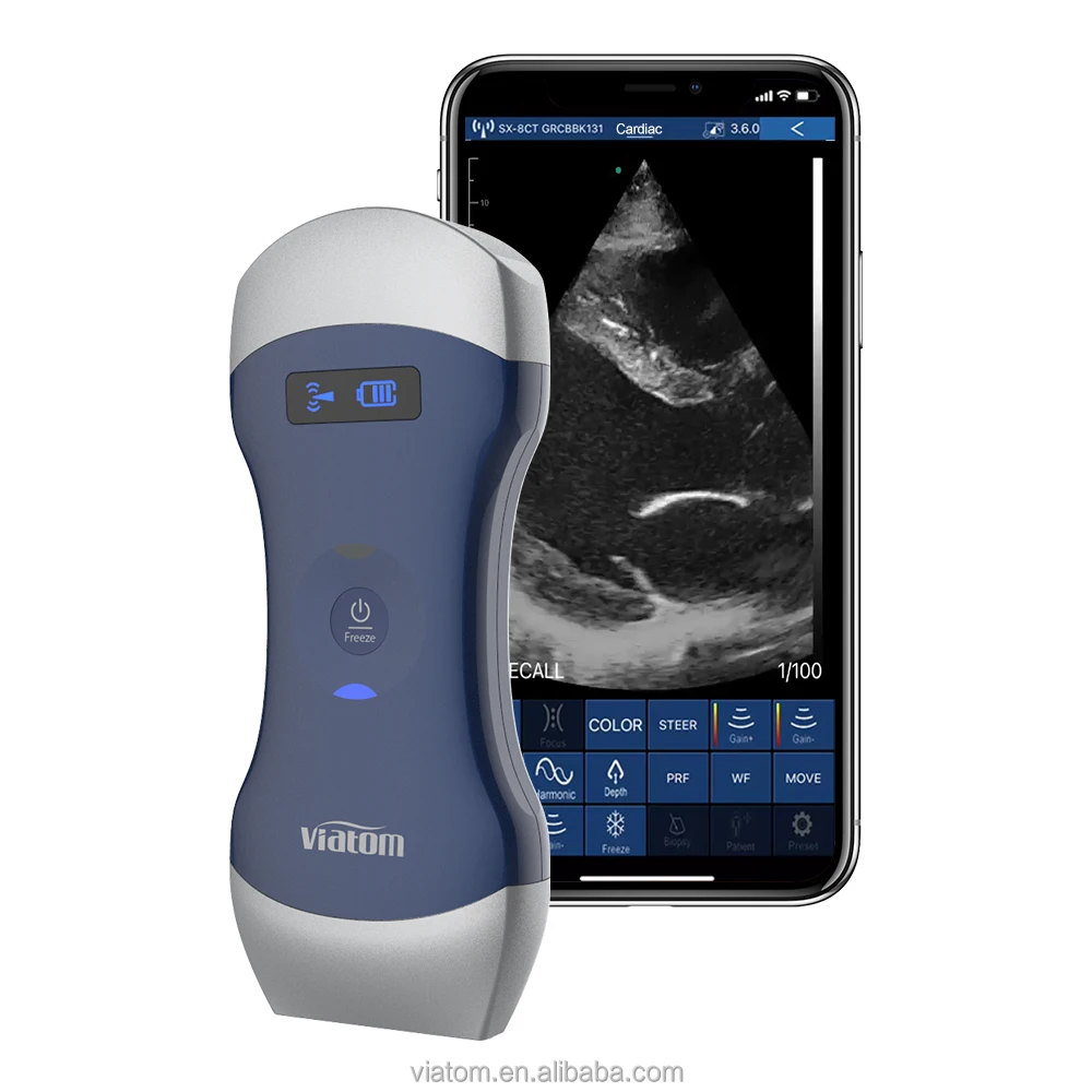 128 Elements Wifi Ultrasound Probe Color Doppler Handheld Wireless Ultrasound Probe Portable Wireless Ultrasound Probe Scanner