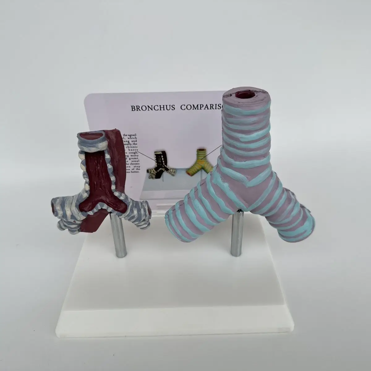 

Модель сравнения Bronchus между курением трахеи и нормальной трахеи, модель человека, медицинская обучающая модель