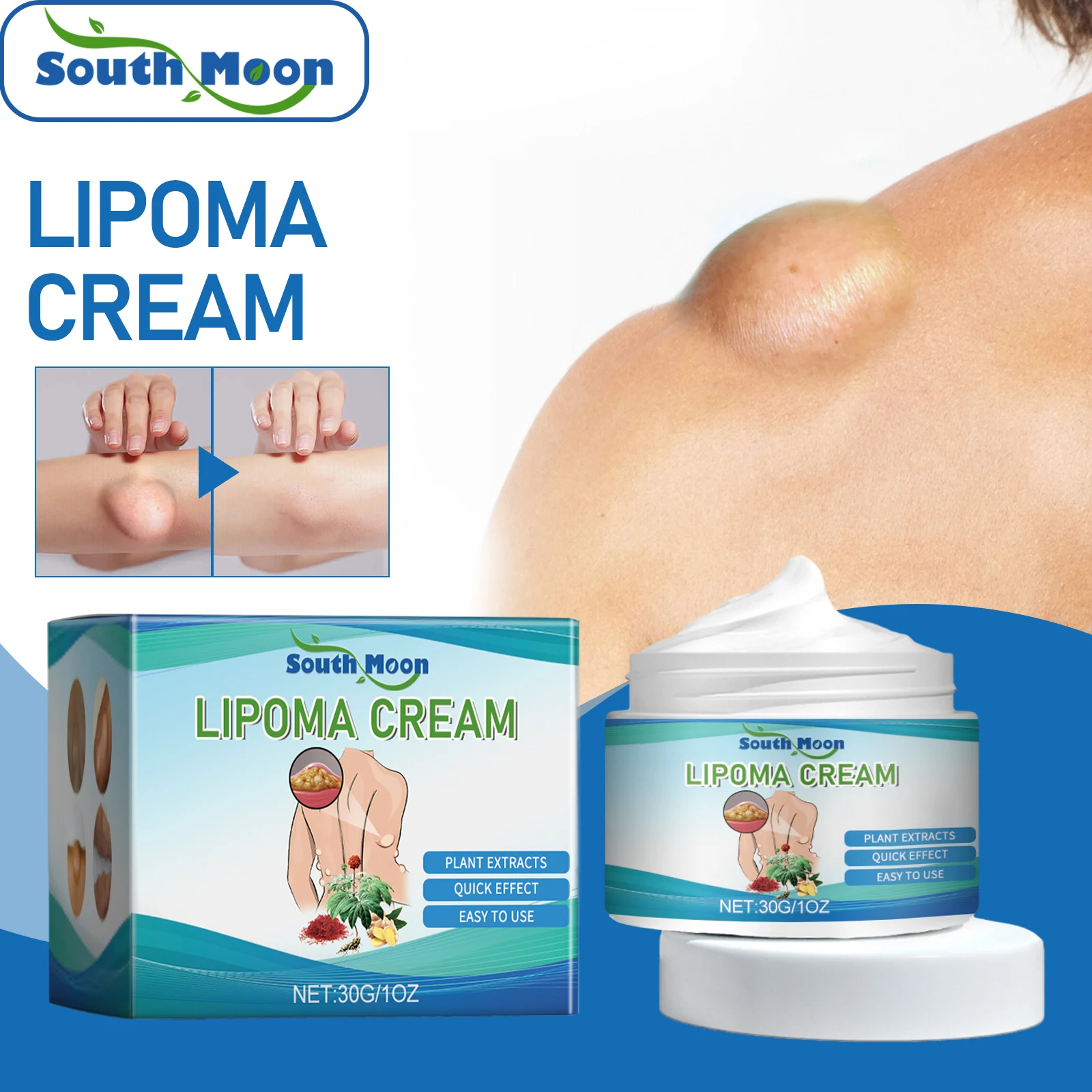 Natural Herbal Lipoma Removal Cream Deep Hydrating Skin Moisturizer Improve Blood Circulation Detox Reduce Body Swelling Skin Co
