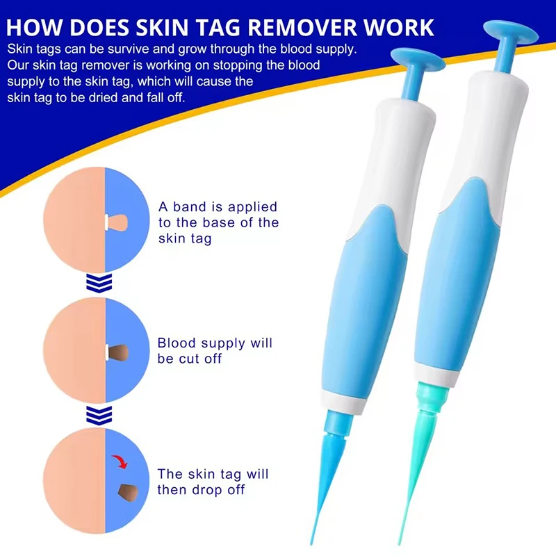 2-IN-1 Auto Skin Tag Removal Tool Kit Painless Skin Label Mole Acne Wart Removal Pen with Cleansing Swabs Facial Skin Care Tool