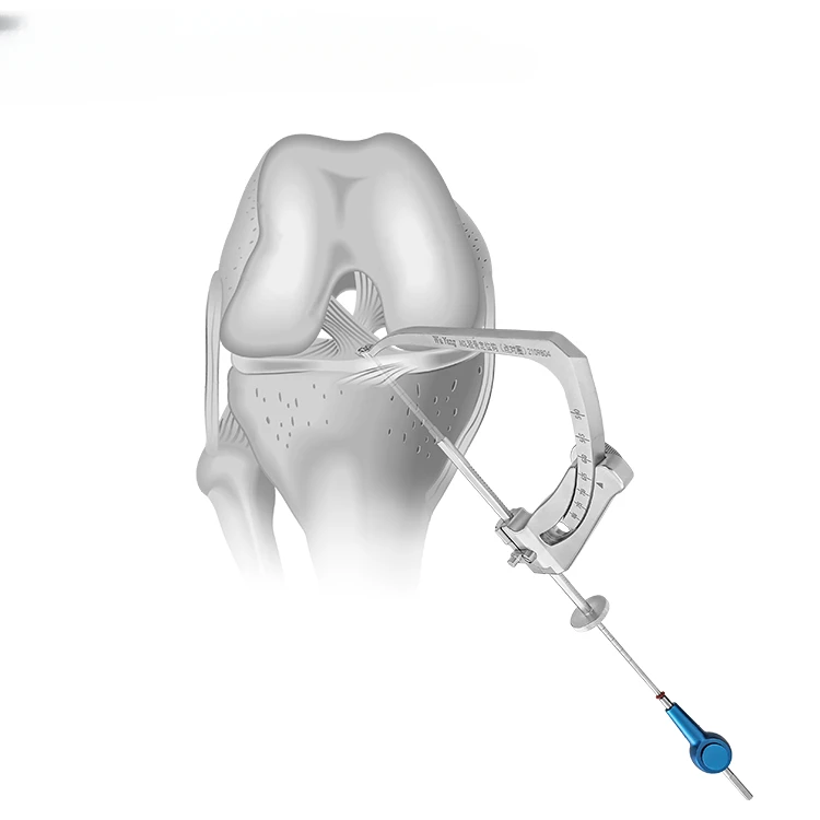 surgical instruments/orthopedic instrument/Sports medicine instrument All-in ACL femoral positioning hook