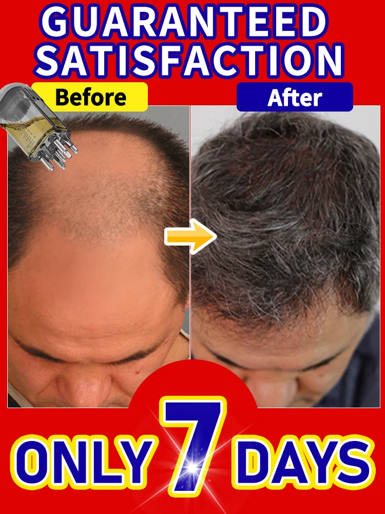 

Portable Scalp Applicator Liquid Comb Hair Roots Massage Medicine Comb Hair For Hair Growth Serum Oil Nourish Massager Brush