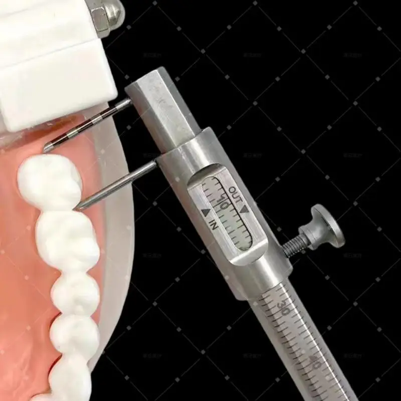 Pied à coulisse numérique dentaire pour la mesure de l'épaisseur des incrustations, des couronnes, des ridules osseuses et de la distance verticale des implants buccaux