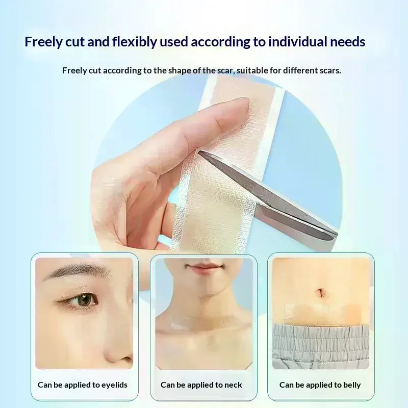 

1 рулон, силиконовые листы для шрамов, пластырь для восстановления кожи, удаление, самоклеящаяся лента от растяжек, шрамы от прыщей, терапевтический пластырь для ухода за кожей, ожогов