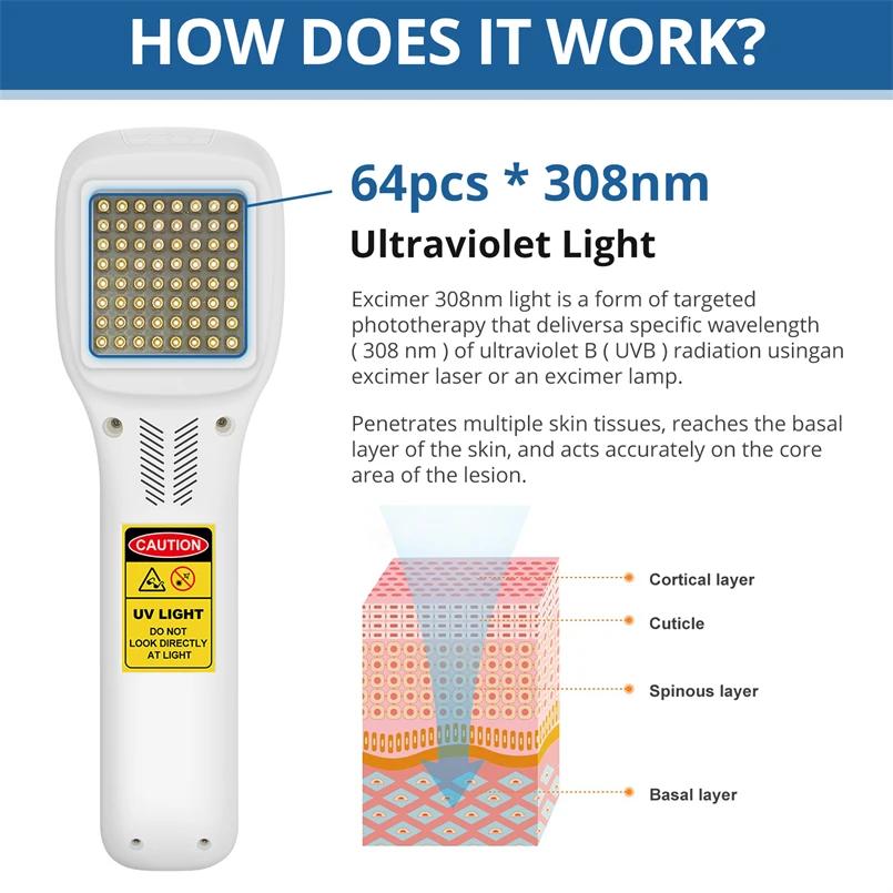 Advanced Phototherapy UVB Light 308nm Vitiligo Treatment Device Blue Light for Pimples Eczema Safe Therapies No Side Effect