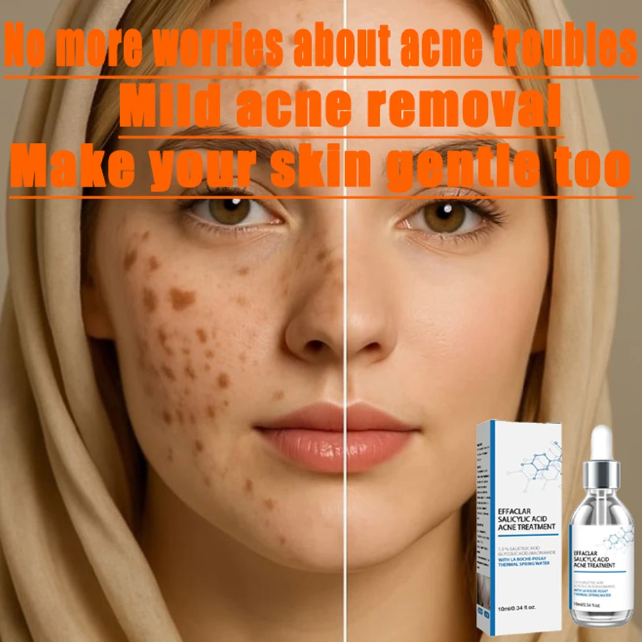 

Anti acne facial essence, acne removing and smoothing skin, collagen protein, hyaluronic acid essence oil, skin care cosmetics