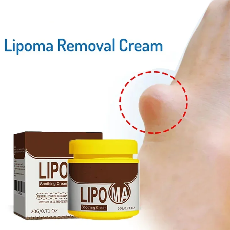 Crema calmante con nudo para el cuidado de la piel, eliminador de bultos subcutáneos, alivia la aglomeración corporal, bloques duros, crema para el cuidado de la piel corporal