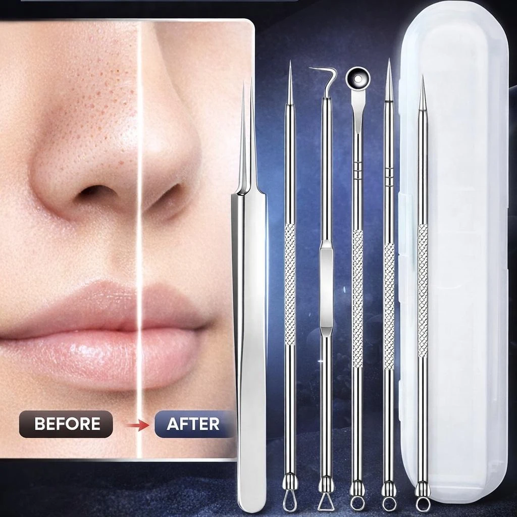 5-teiliges professionelles Mitesserentfernungs-Set mit Nadel & Haken, geeignet für Frauen, Porenreiniger, Komedonenextraktor für Pickel und Hautunreinheiten