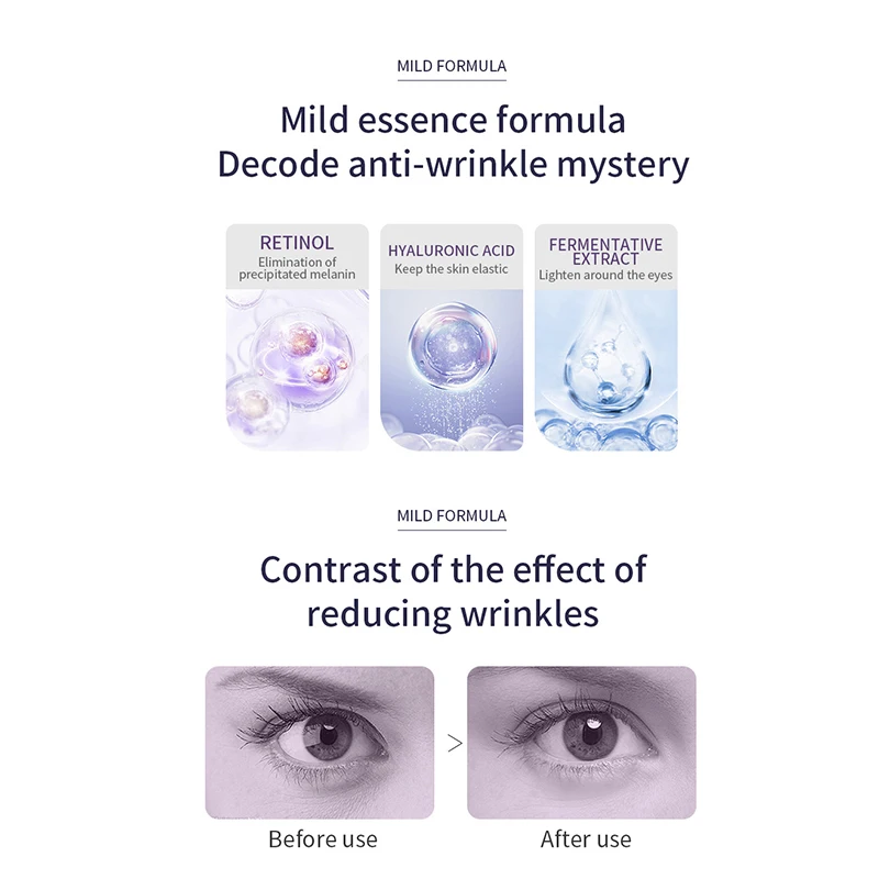 Anti Wrinkle Anti Dark Circle Eye Cream Roller Massager Moisturizing Eye Bags Anti Aging Hyaluronic Acid Eye Skin Care Products