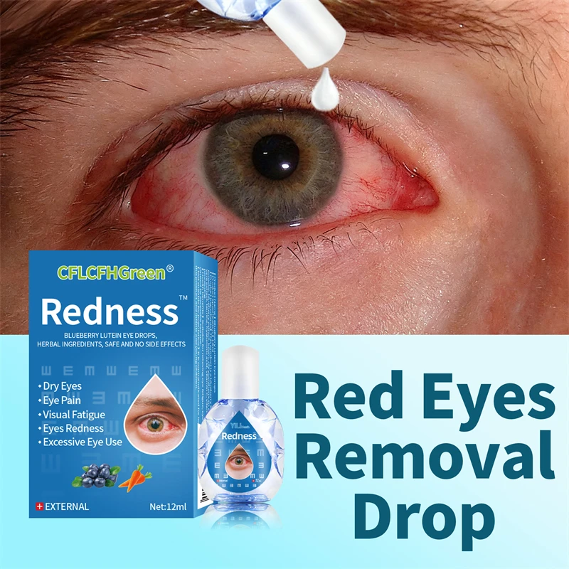 Red Eye Treatment Eye Drops For Bloodshot Eyes Infection Redness Relief Chinese Medicine 12Ml