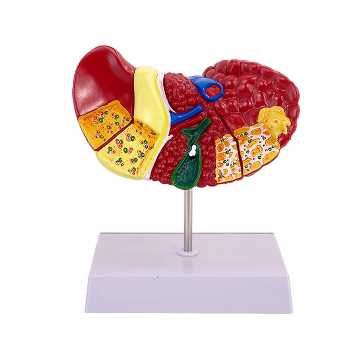 

Liver Model for Common Pathologies, Liver Model Human Anatomy Doctor Office Anatomy Model