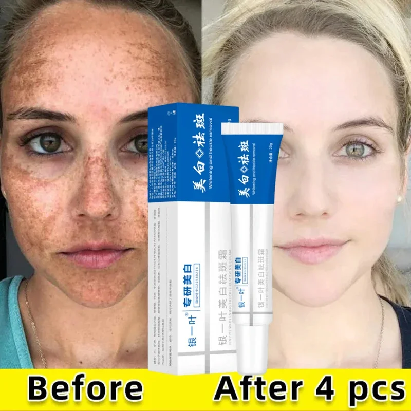 

Китайский астрагаловый отбеливающий крем для веснушек эффективное удаление мелазмы темные пятна крем темно-желтая кожа осветляет уход за кожей