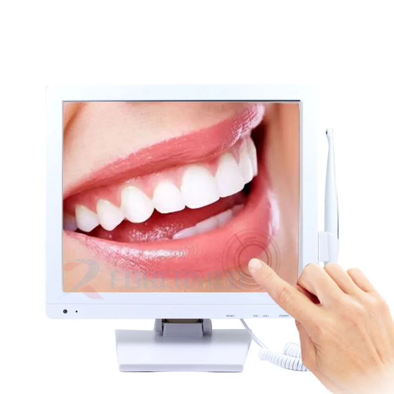 Tooth Examination Wireless Dentl Scanner Portable Handheld Intraoral Endoscoe