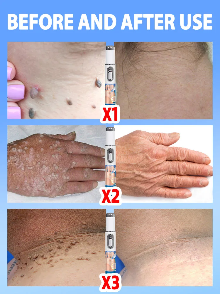 

solution to skin problems