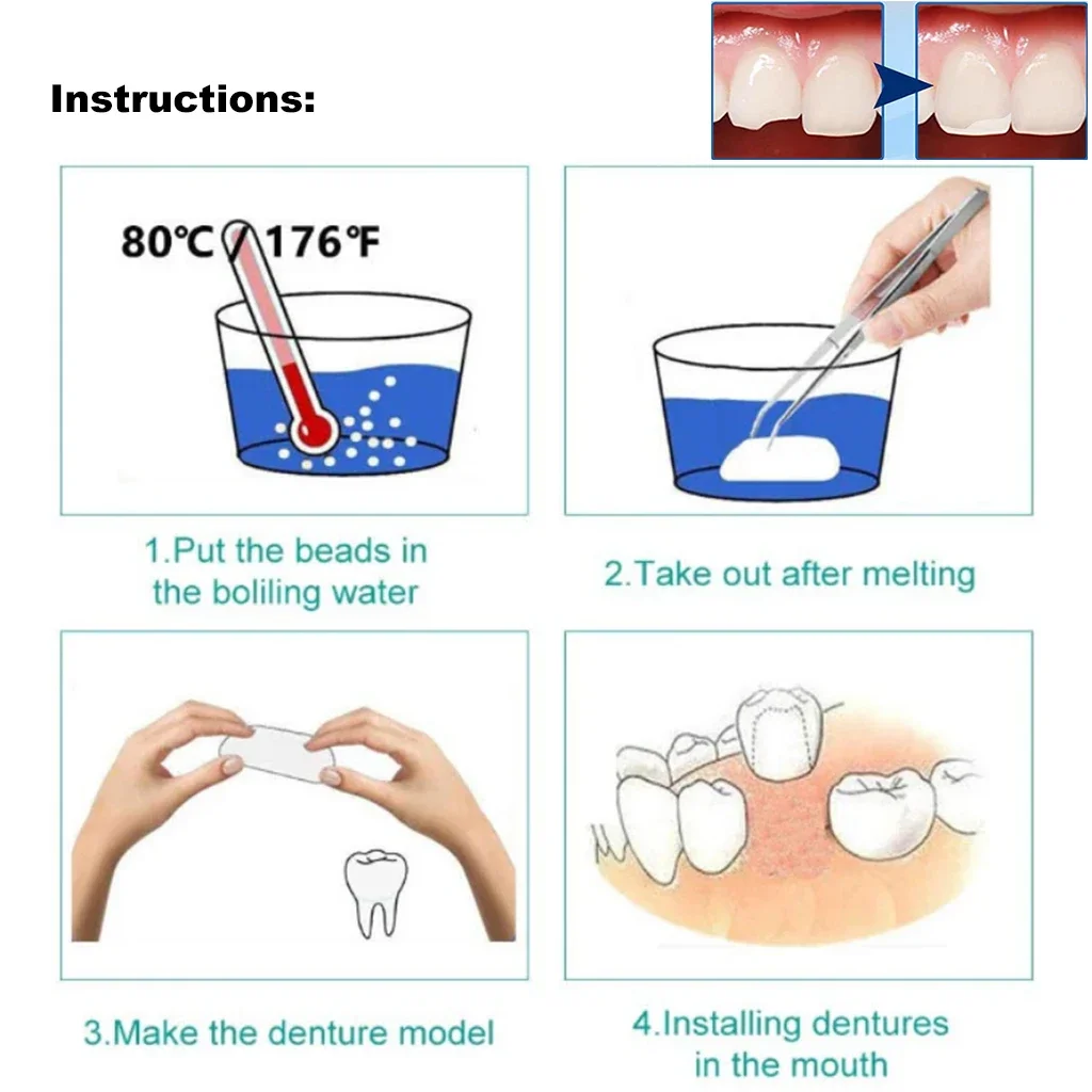 100g ฟันชั่วคราวซ่อมฟันและช่องว่าง FalseTeeth กาวแข็งกาวฟันปลอมฟันไวท์เทนนิ่งบรรจุหัก Fangs ฮาโลวีน