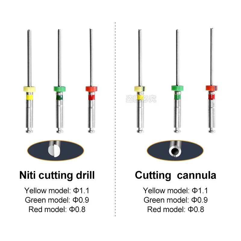 Kit sistema di rimozione File Endo endodontico dentale/Set di strumenti per la rimozione di File rotti Endo estrattore di File del canale radicolare per clinica