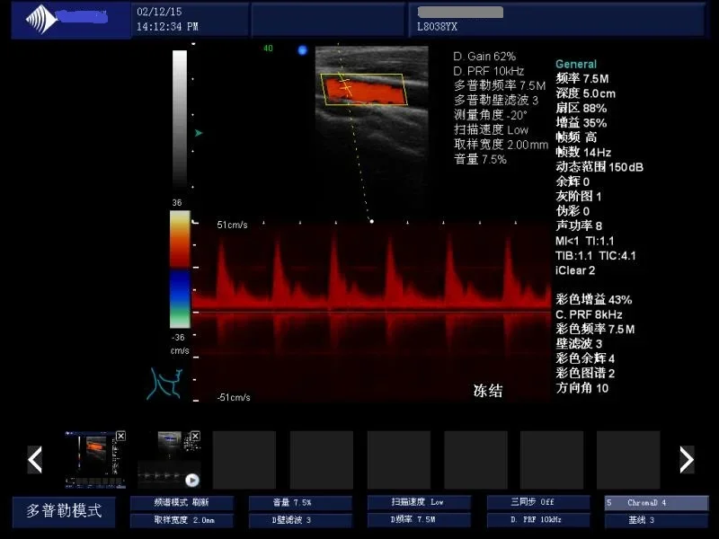 ALG-DU70 Portable  Color Doppler  Full digital 3D or 4D  laptop ultrasound scanner  Medical ultrasound  machine instruments