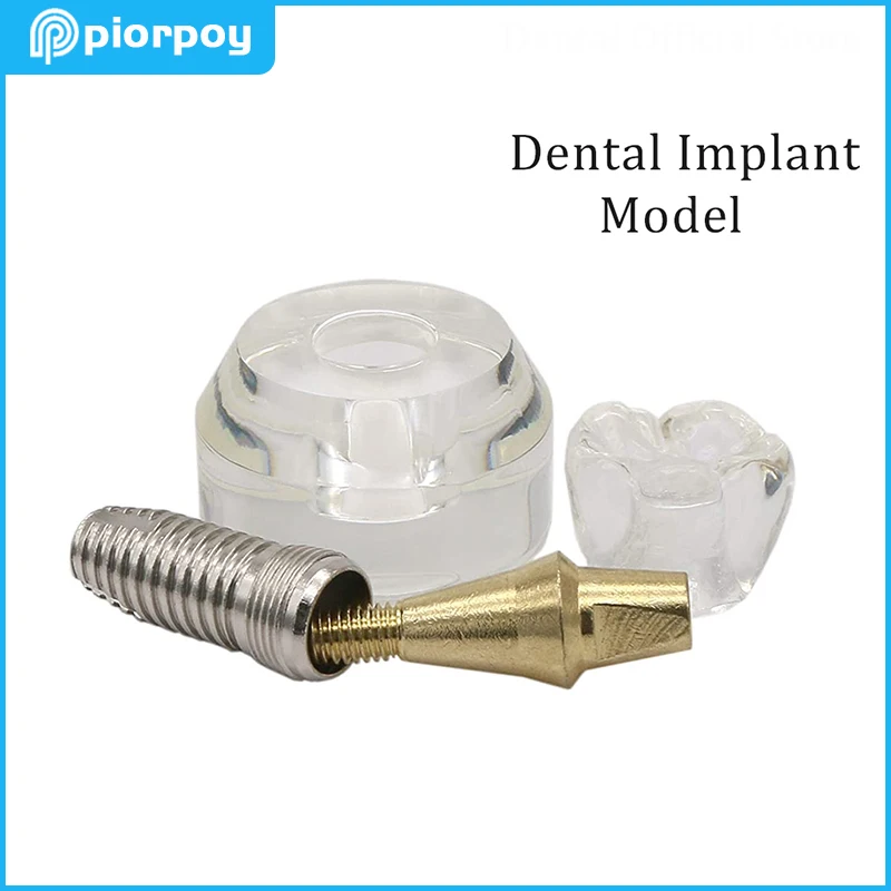 

1 Pcs Dental Implant Model Detachable Demonstration Teeth Study Training Teaching Models Transparent Odontologia Accessories