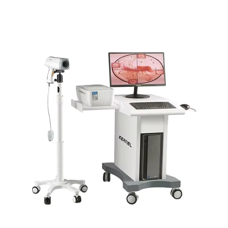 Video Colposcope KN-2200 Harga colposkopik Colposcope untuk ginekologi