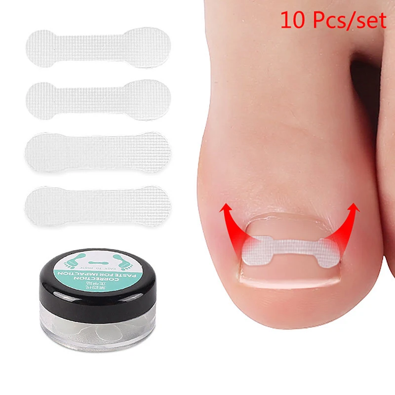 10Pcs Ingrown Toe Nail Correction Sticker Patch Paronychia Corrector Treatment