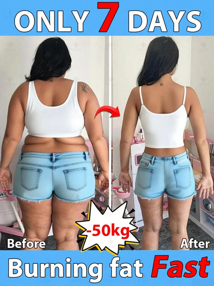 

The best ᴡᴇɪɢʜᴛ ʟᴏss ᴀɴᴅ ғᴀᴛ ʙᴜʀɴɪɴɢproduct in 2025, ʀᴇᴅᴜᴄᴇ ʙᴇʟʟʏ, ᴀʀᴍ ᴀɴᴅ ʟᴇɢ ғᴀᴛ, ʟᴏsᴇ 50 ᴘᴏᴜɴᴅs ᑫᴜɪᴄᴋʟʏ ɪɴ 7 ᴅᴀʏs