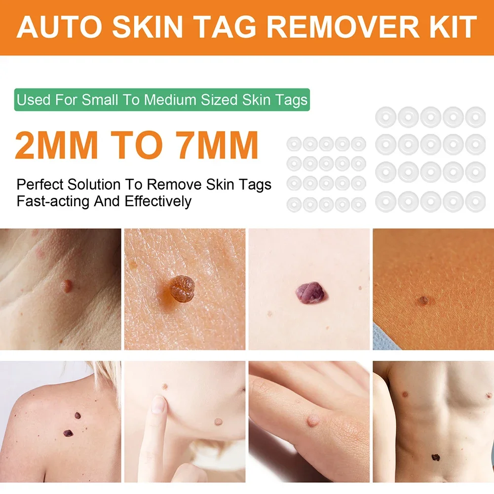 Double Sided Wart Treatment Face Skin Tag Removal เครื่องมือสิว Tag Remover Face Skin Tag Removal Patch