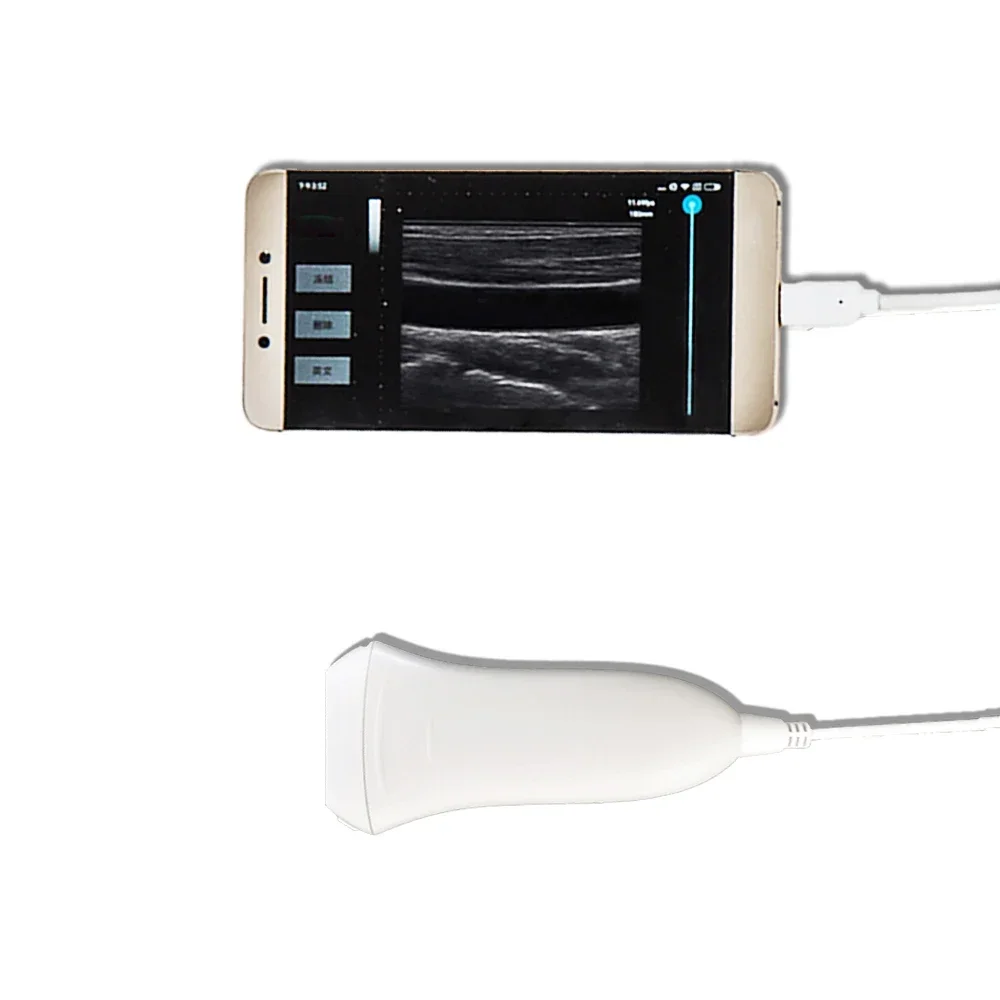 Amain Magiq 2L Hd Lineaire Gehumaniseerd Interface Draagbare Hoge-Frequentie Diagnostiek Ultrasound Faciliteit