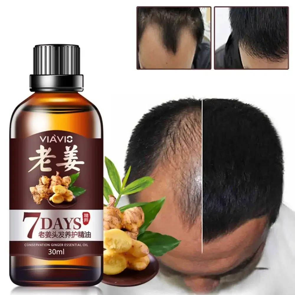 Fast Hair Growth Essential Oil Effective Hair Loss Treatment Regrowth Ginger Serum Hair Health Care Beauty