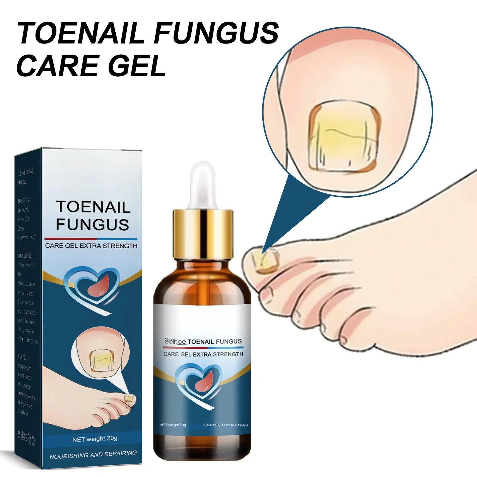 Uñas Zehen nagel Reparatur 20g Nagel Reparatur für beschädigte Nägel für Zehen nagel oder Fingernagel sichere Nagel lösung für verfärbte beschädigte Nägel