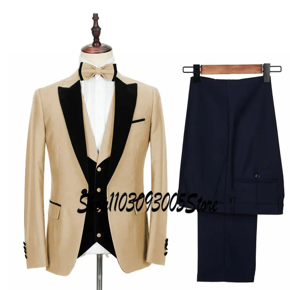 New Business Dark Green Formal Men's Slim Fit Suits 3 Pieces Wedding Groom Prom Terno Masculino Custom Blazer Vest Pant Sets