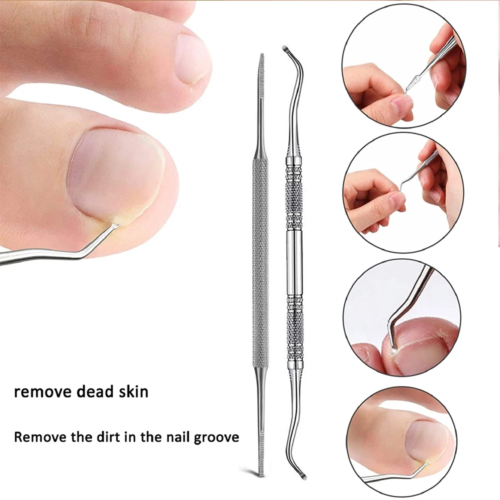 Ingrown Toenail Tools Set Ingrown Toenail Correction Patch Stickers Corrector Pedicure Tool Ingrown Toe Nail Treatment Foot Care