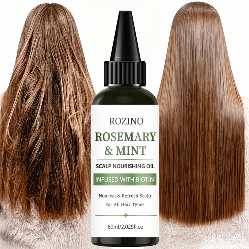 Rozino Rosemary Mint Scalp Essence Oil, Imported Rosemary Plant Extract from Portugal, with Added Biotin, Lightweight Oily Texture, Soothes the Scalp Surface, Fresh Herbal Aroma, Rosemary Mint Plant Extract, Instantly Refreshes the Scalp, Smooth Application, a Home-Use Scalp Refresh Product
