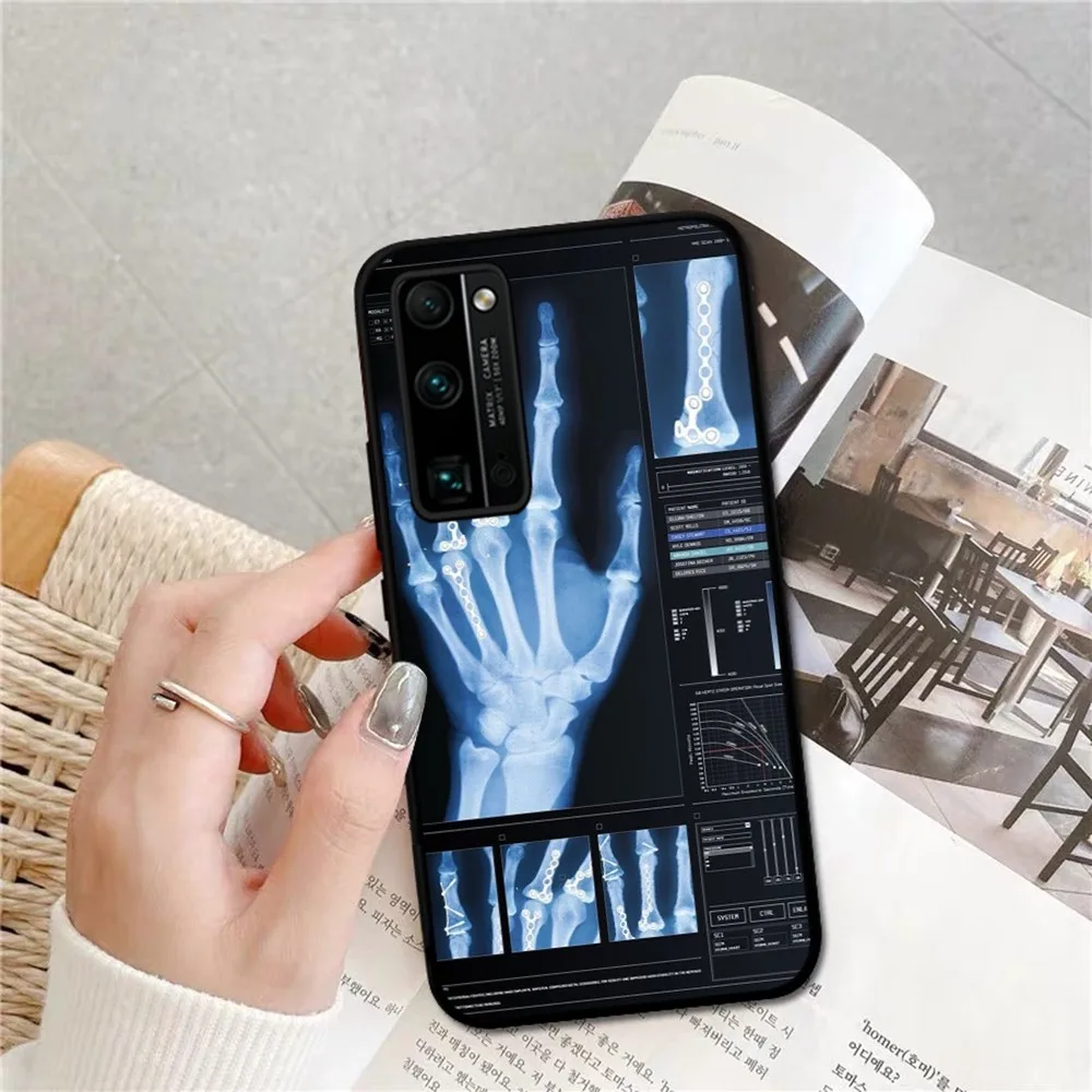 Radiological human organs Skeleton Phone Case For Huawei Honor 10 lite 9 20 7A 9X 30 50 60 70 pro plus Soft Silicone Cover