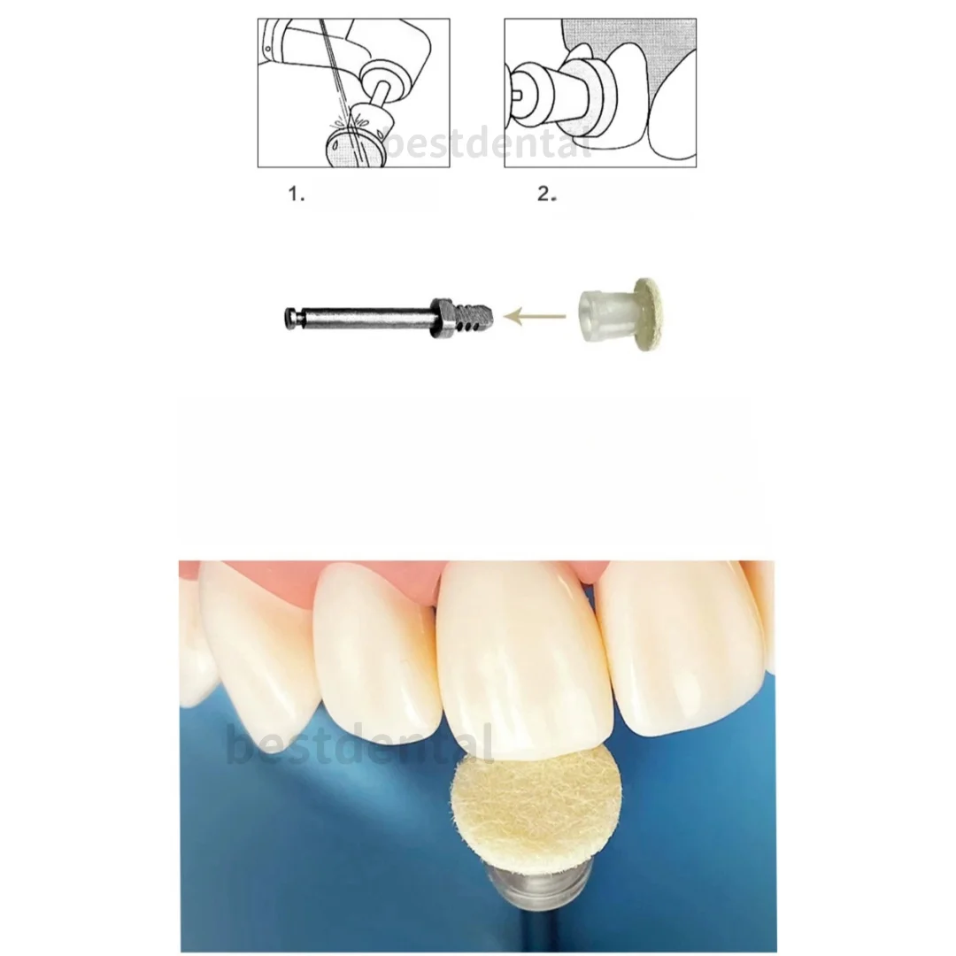 ทันตกรรมคอมโพสิตขัดดิสก์วาง Impregnated Felt ล้อ 50 ดิสก์ 1 PC Mandrel ทิ้งขัด